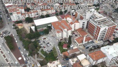 Akhisar’da Yeni Dönem: Lazerle Kesisiz Böbrek Taşı Tedavisi