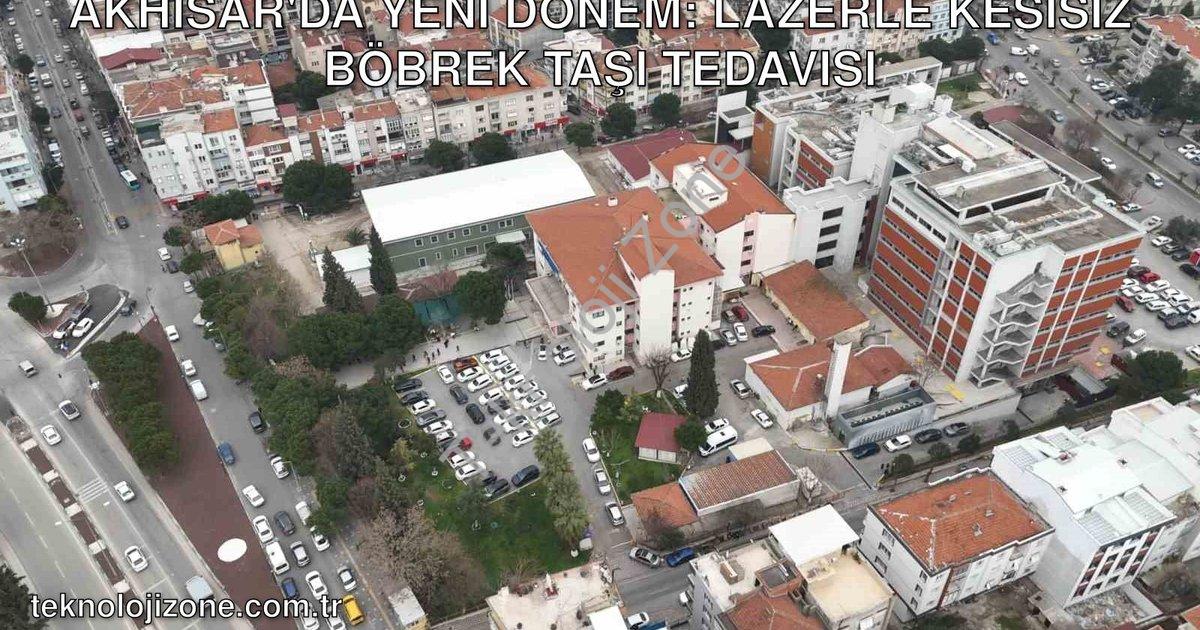 "Akhisar'da Yeni Dönem: Lazerle Kesisiz Böbrek Taşı Tedavisi" başlıklı haber için fotorealistik, pro